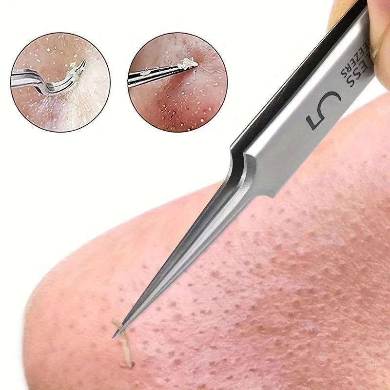 No. 5 Extra Fine Cellular Acne Blackhead Removal Tweezers