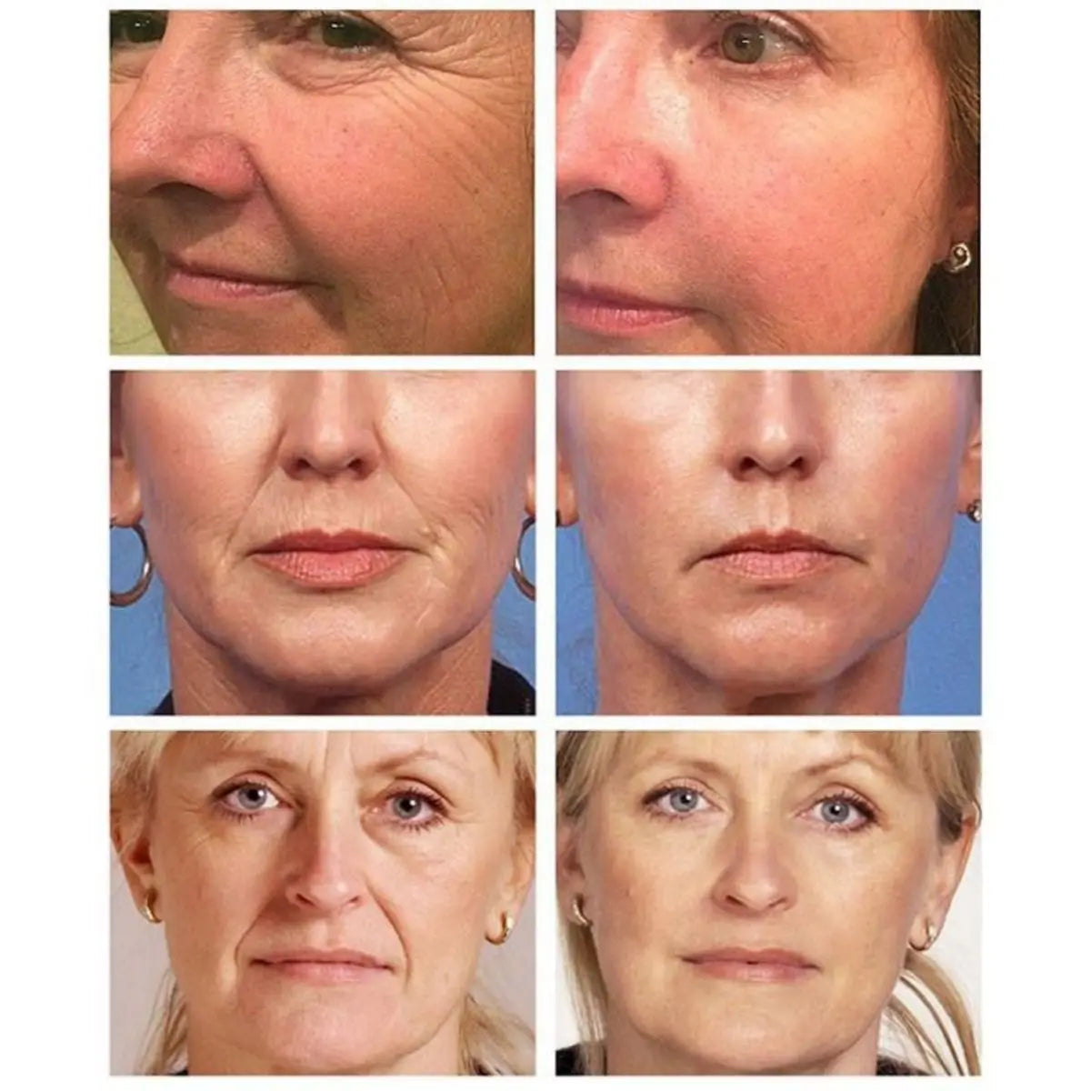 Retinol Anti-Aging Face Cream – Wrinkle Repair