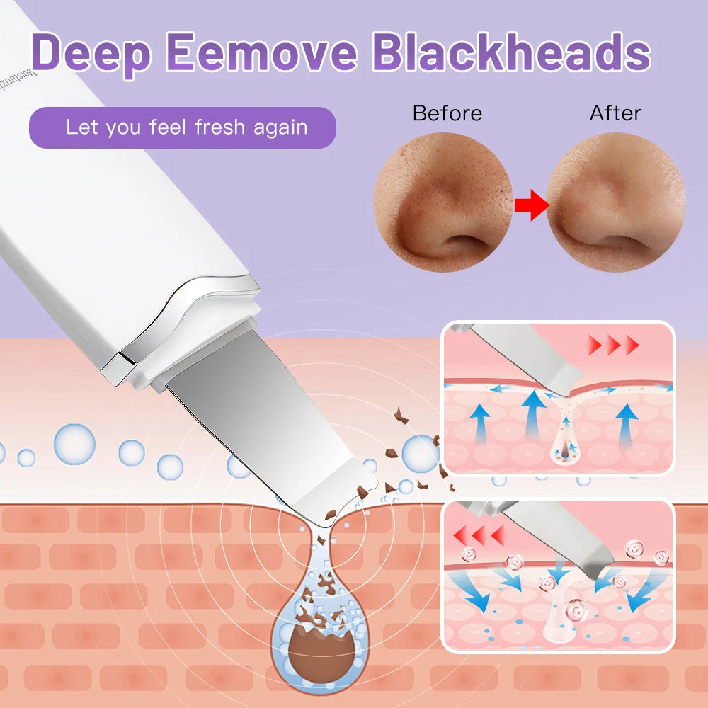 Electric Ultrasonic Skin Scrubber Vibration Face Spatula
