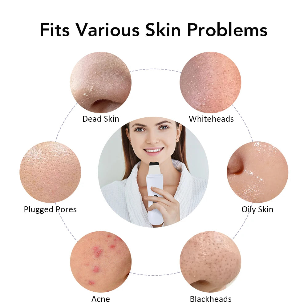 Ultrasonic Skin Scrubber, Skin Spatula Ion Deep Face