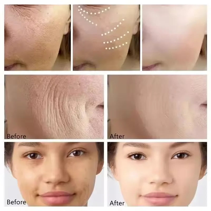Collagen Bounce Balm Stick – Wrinkle Removal