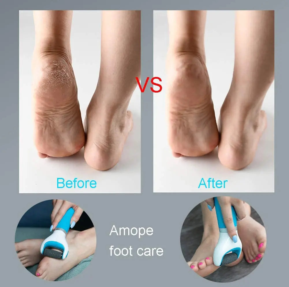 Foot Care Tool Electric Foot File Foot Callouses Dead Skin Remover