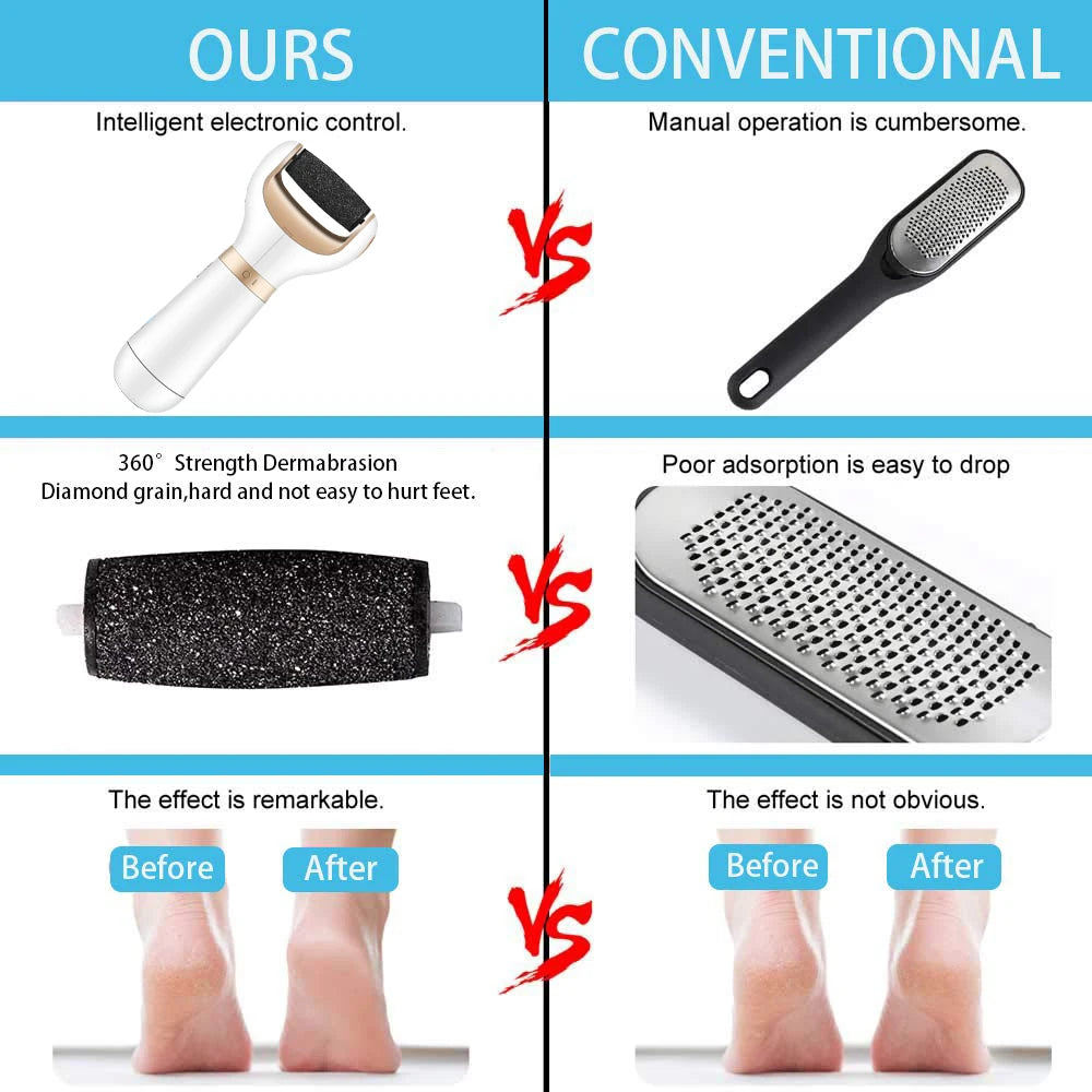 Foot Care Tool Electric Foot File Foot Callouses Dead Skin Remover