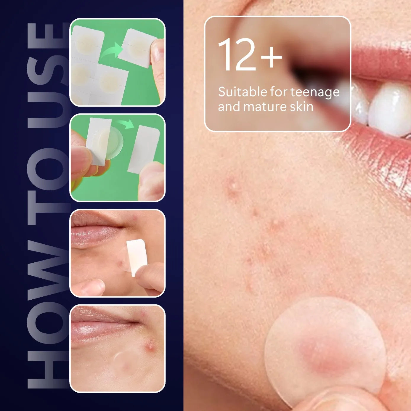 Micro Needle Pimple Patch (24 Pack) Hydrocolloid Micropoint Pimple Patch For Acne & Pimples Microdart Patch, Micro Dart Pimple P