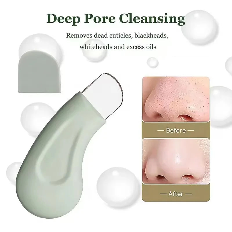 Blackhead & Whitehead Removal Tool – Face & Nose