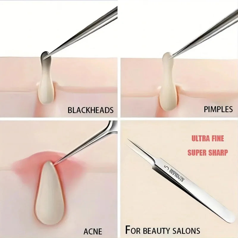 No. 5 Extra Fine Cellular Acne Blackhead Removal Tweezers